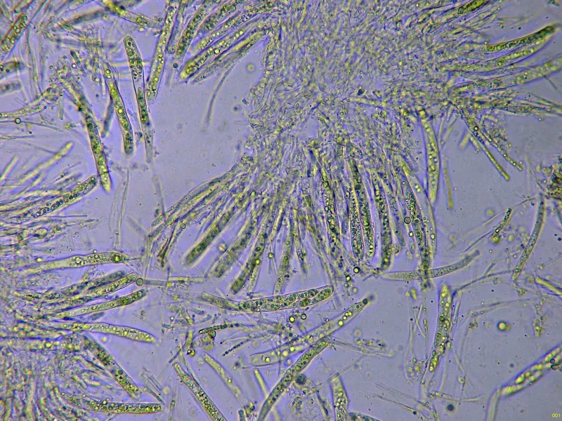 Hymenoscyphus kathiae 10 - Ascos agua x 400-001